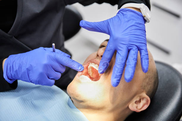 Best Broken or Chipped Tooth Repair in Spanish Fort, AL
